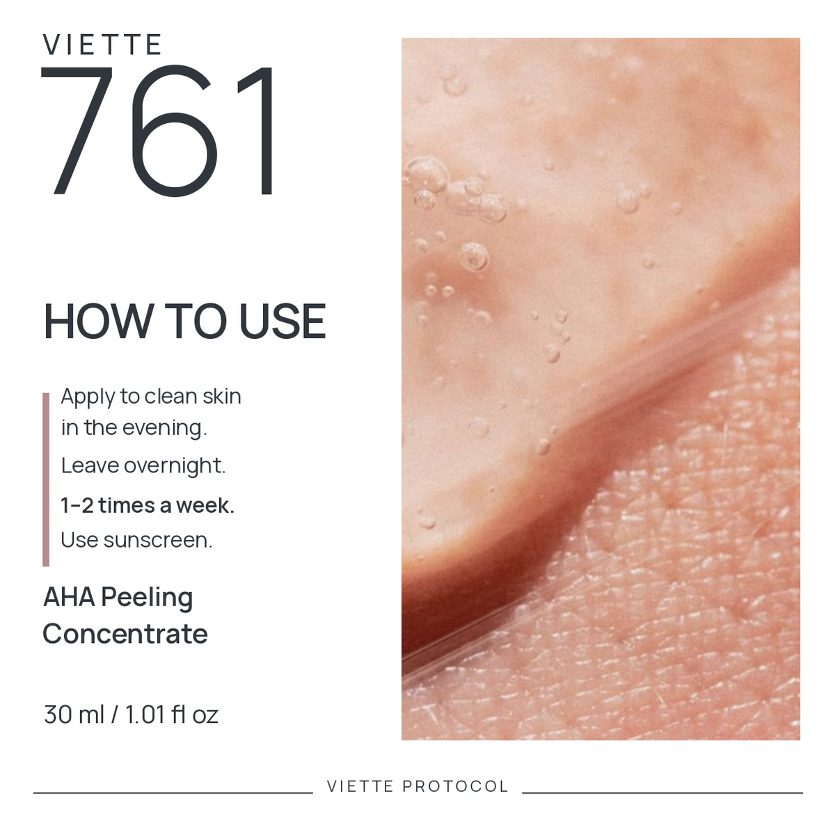 VIETTE PROTOCOL 761 — how to use